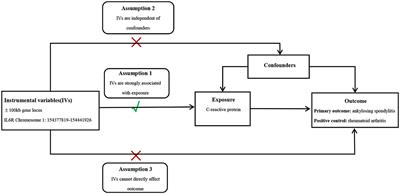 Therapeutic potential of single-nucleotide polymorphism-mediated IL6R inhibitors in ankylosing spondylitis treatment